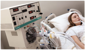 Woman on Ventilator